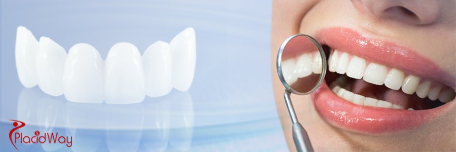 Best Dental Bridges at Smile Studio in Croatia at Affordable Prices banner image